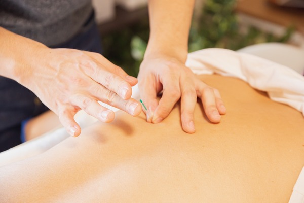 Alternative Therapy Guide - Acupuncture